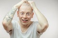 Emotional overjoyed surprised Albino male model with bugged eyes and open mouth.