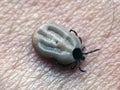 Encephalitis Tick