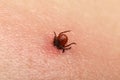 Encephalitis tick Royalty Free Stock Photo