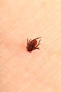 Encephalitis tick