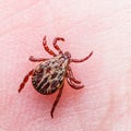 Encephalitis Virus or Lyme Borreliosis Disease Infected Tick Arachnid Insect Crawling on Skin