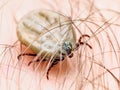 Encephalitis Virus or Lyme Disease or Monkey Fever Infected Tick Arachnid Insect on Skin Royalty Free Stock Photo