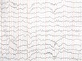 encephalogram on paper, trace of activity of brain