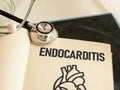Endocarditis is shown using the text as medical concept Royalty Free Stock Photo