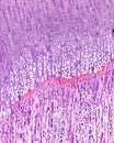 Endochondral ossification. Growth plate