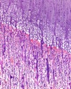 Endochondral ossification. Growth plate