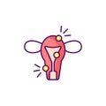 Endometriosis RGB color icon Royalty Free Stock Photo
