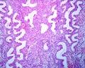 Endometrium. Secretory phase Royalty Free Stock Photo
