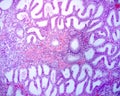 Endometrium. Secretory phase Royalty Free Stock Photo