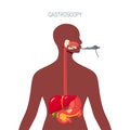 Endoscopy diagnostic, concept in flat style