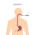 Endoscopy stomach anatomy equipment vector illustration. Esophagus endoscope body exam, gastroscopy human instrument Royalty Free Stock Photo