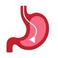 Endoscopy vector icon Royalty Free Stock Photo