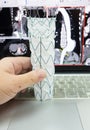 Endovascular stent graft