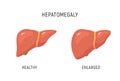 Enlarged liver hepatomegaly disease icon. Human liver health illustration anatomy design