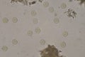 Entamoeba coli cysts stage in stool exam