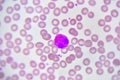 Eosinophil cell Royalty Free Stock Photo