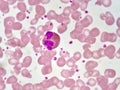 Eosinophil cell Royalty Free Stock Photo
