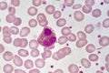 Eosinophil cell