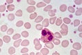 Eosinophil cell Royalty Free Stock Photo