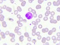 Eosinophil cell