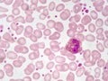 Eosinophil cell Royalty Free Stock Photo