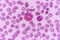 Eosinophil