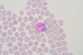 Eosinophil