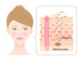 healthy skin cell turnover on young womanâs face illustration. Beauty skin care concept