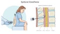 epidural anesthesia structure diagram medical Royalty Free Stock Photo