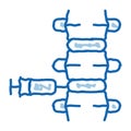 epidural spinal anesthesia doodle icon hand drawn illustration