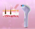 Epilation procedure. Modern appliance and illustration of hair follicles on background