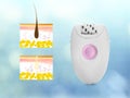 Epilation procedure. Modern appliance and illustrations of hair follicle on blue background