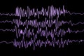 Epilepsy awareness. Electroencephalography in epilepsy patient during seizure attack