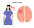 epilepsy seizure concept