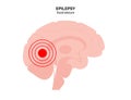 epilepsy seizure concept