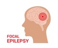 Epilepsy vector icon