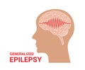 Epilepsy vector icon