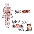 Episacral lipoma or back mouse