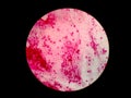 Epithelial cell - Gram stain. Sample: tracheal aspirate