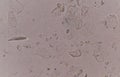 Epithelial tissue with bacteria cells yeast cells