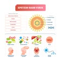 Epstein barr virus vector illustration. Labeled herpes disease explanation. Royalty Free Stock Photo