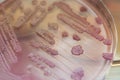 Escherichai coli colonies as test on MacConkey agar plate. Focu Royalty Free Stock Photo