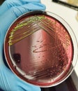 Escherichia coli bacteria growth on Eosin Methylene Blue agar
