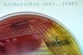 Escherichia coli colonies as test on MacConkey agar plate. Focus