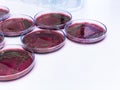 Escherichia coli E.coli cultured with Eosin Methylene Blue EMB Agar in Petri dish show the metallic green sheen colonies.