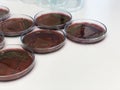 Escherichia coli E.coli cultured with Eosin Methylene Blue EMB Agar in Petri dish show the metallic green sheen colonies using Royalty Free Stock Photo