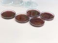 Escherichia coli E.coli cultured with Eosin Methylene Blue EMB Agar in Petri dish show the metallic green sheen colonies using Royalty Free Stock Photo