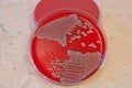 Escherichia Colli bacteria isolated on petri dish