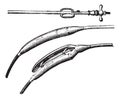 Esophageal dilator, vintage engraving