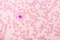 Essential thrombocytosis blood smear